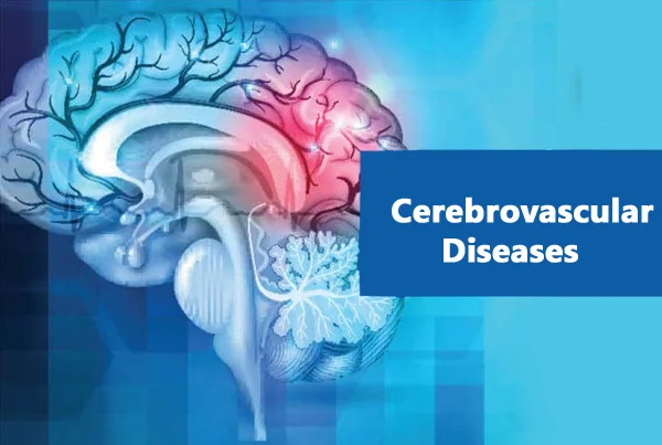 Cerebrovascular Diseases