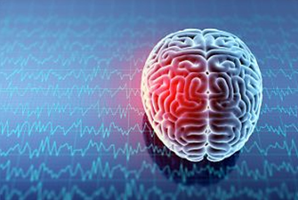 Neurotrauma