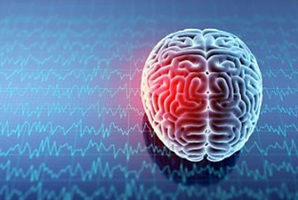 Neurotrauma